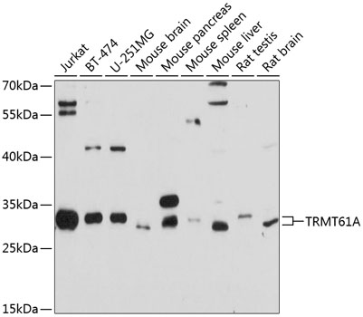 TRMT61A antibody产品图