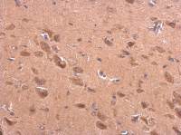 BACE2 antibody [C1C3]