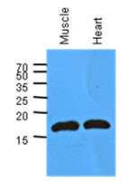Myoglobin antibody [AT6E10]