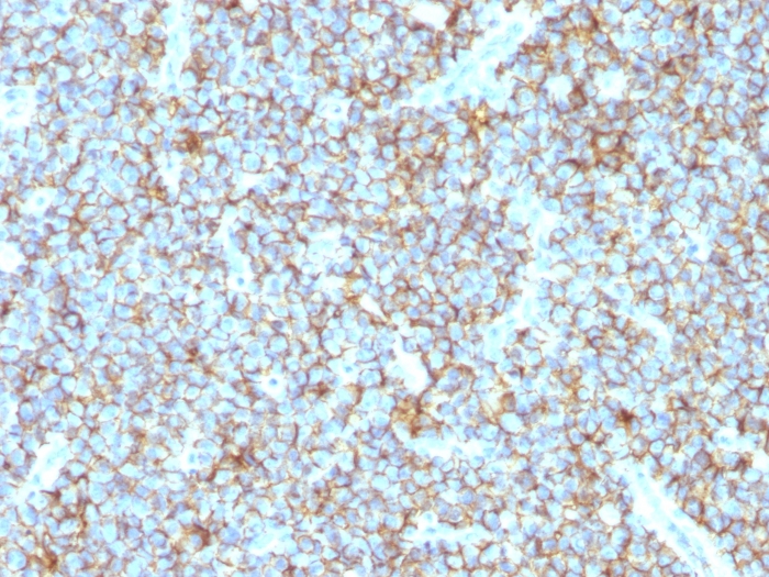 CD99 antibody [MIC2/1495R]
