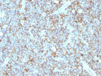 CD99 antibody [MIC2/1495R]