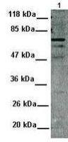 MDMX antibody, N-term