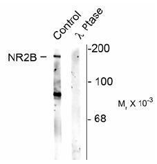 NMDAR2B (phospho Ser1480) antibody