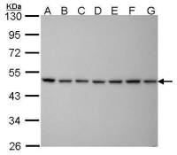 PSMC5 antibody [25D5]