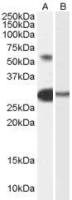 TCFL5 antibody, Internal