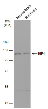 HIP1 antibody