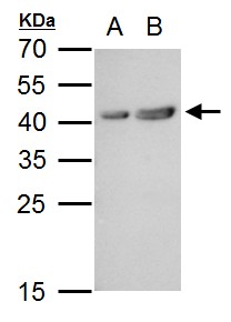 MT2 antibody