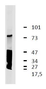 GARP antibody [GARP5]