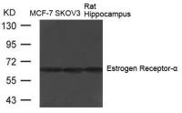 Estrogen Receptor alpha antibody