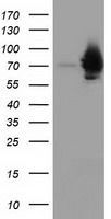 HSPA6 antibody [2C2]