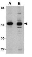 ALDH3A1 antibody