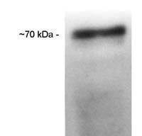 CETP antibody [ATM192]