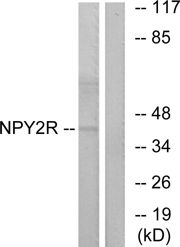 NPY2R antibody