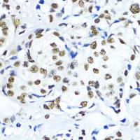 Histone H3K79me3 (tri-methyl Lys79) antibody