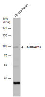 ARHGAP17 antibody