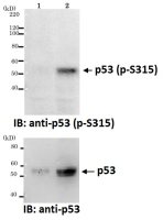 p53 (phospho Ser315) antibody [#18]