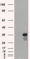 CD2 antibody [4E4]