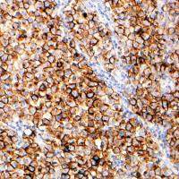 Placental Alkaline Phosphatase antibody [SP15] (ready-to-use)