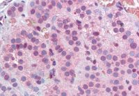 MBD2 (isoform 1) antibody, Internal