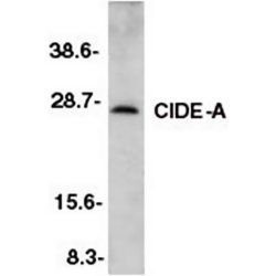 CIDE A antibody