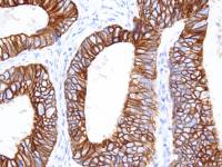 Cytokeratin 18 antibody [IHC018]