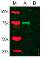 MMP2 antibody