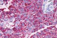 F2RL3 / PAR-4 antibody