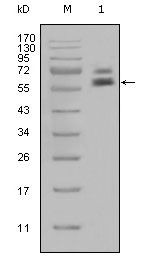 Cytokeratin 5 antibody [1E1]