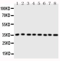Annexin III antibody