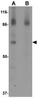 ESRP1 antibody