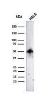 FOXA1 antibody [FOXA1/2230R]