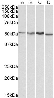 AKT3 antibody, Internal