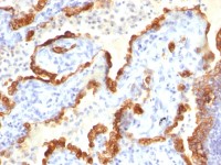 Cytokeratin 18 antibody [Cocktail]