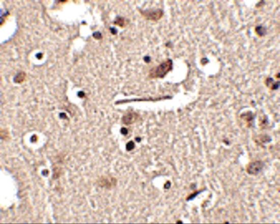 SLITRK2 antibody