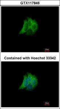 RAB17 antibody [N1C3]
