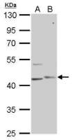 PHKG1 antibody [N1C3]