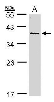 AKR7A3 antibody [N3C3]