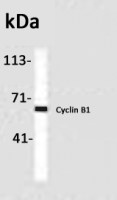 Cyclin B1 antibody [GNS1]