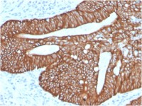Cytokeratin 18 antibody [KRT18/2819R]