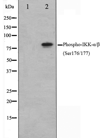 IKK alpha (phospho Ser176) + IKK beta (phospho Ser177) antibody