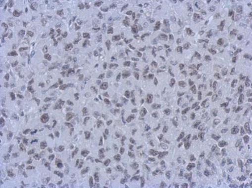 RbAp48 + RbAp46 antibody [15G12]
