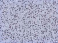 RbAp48 + RbAp46 antibody [15G12]