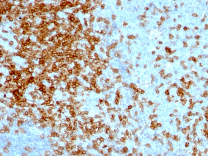 CD43 antibody [84-3C1]