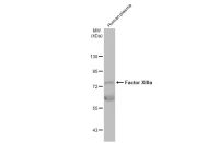 Factor XIIIa antibody [N1N3]
