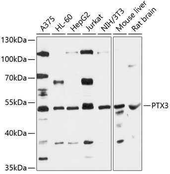 Pentraxin 3 antibody