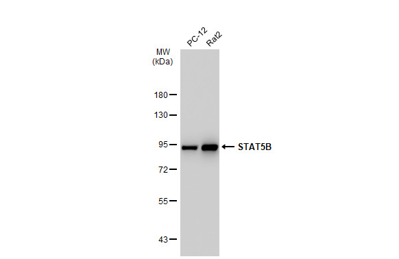 STAT5B antibody [SD08-08]