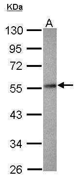 PPP2R2D antibody [N2C3]