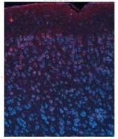 FIBCD1 antibody, C-term