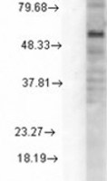 GABA A Receptor delta antibody [S151-3]
