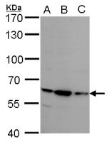 Steroid sulfatase antibody